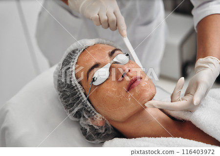 A woman applies gel to her face before a laser procedure. 116403972