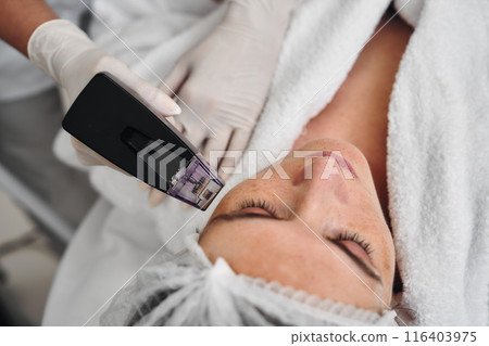 A woman receives Rf-lifting in a beauty salon. 116403975