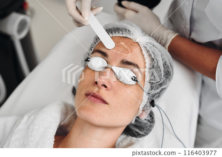A woman applies gel to her face before a laser procedure. 116403977