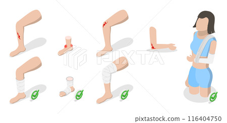 3D Isometric Flat  Illustration of How To Heal Injuries, Methods of Bandaging 116404750
