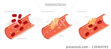 3D Isometric Flat Illustration of Hemostasis, Wound Healing Process 3D Isometric Flat Illustration of Hemostasis, Wound Healing Process 116404763
