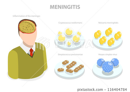3D Isometric Flat  Illustration of Meningitis, Meningococcal Disease, Dangerous Meninges Inflammation 116404784