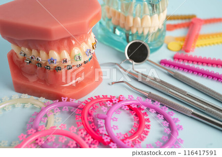 Orthodontic ligatures rings and ties, elastic rubber bands on orthodontic braces, model for dentist studying about dentistry. Orthodontic ligatures rings and ties, elastic rubber bands on orthodontic braces, model for dentist studying about dentistry. 116417591