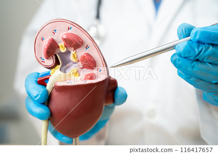 Kidney disease, Chronic kidney disease ckd, Doctor hold human model to treat and study in hospital. 116417657