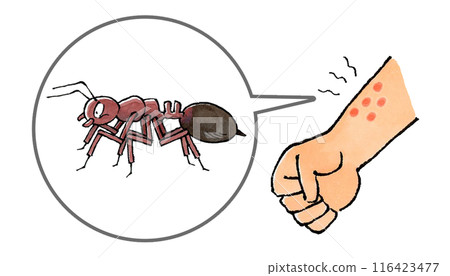 手臂被紅火蟻蟄了 手臂被紅火蟻蟄了 116423477