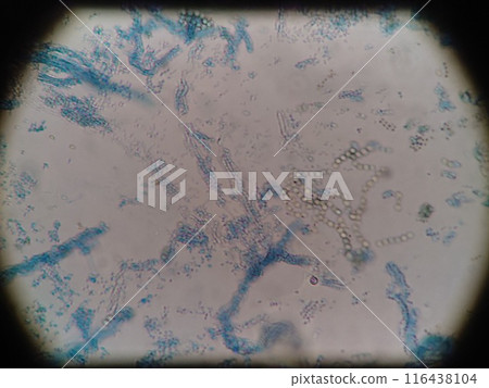 Microscopic photo of mold on a refrigerator shelf Microscopic photo of mold on a refrigerator shelf 116438104