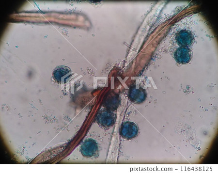 Mold spores in the refrigerator 116438125