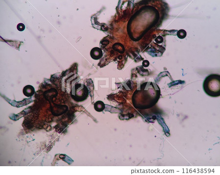 倉庫裡的蟎蟲顯微照片 116438594