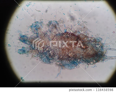 Microscopic photo of mites found in a warehouse 116438598