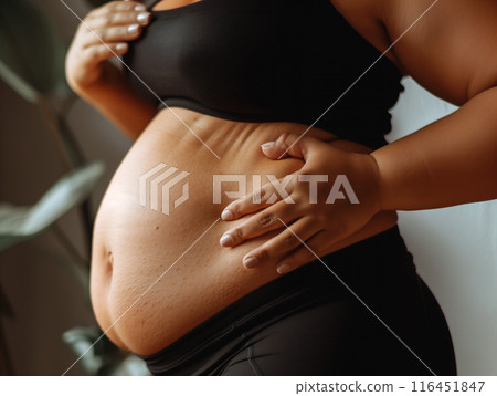 Fat belly of a woman. female hand of excessive fat on the belly. diet lifestyle concept to shrink belly and form healthy abdominal muscles. 116451847