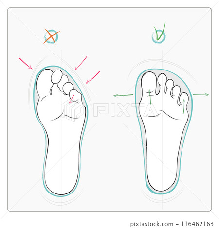 Right wrong shoes, barefoot, healthy feet, flat vector illustration 116462163