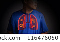 Lung cancer. 3d x-ray concept 116476050