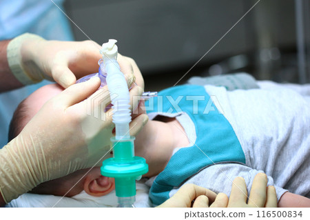 Anesthesia during surgery. Oxygen mask on the child's face. Surgical intervention. The use of sedatives. 116500834