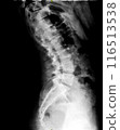 X-ray of lumbar spine and pelvis. Lateral view. Vertebrae and intervertebral joints of lower back and coccyx. Healthy backbone anatomy radiography image 116513538