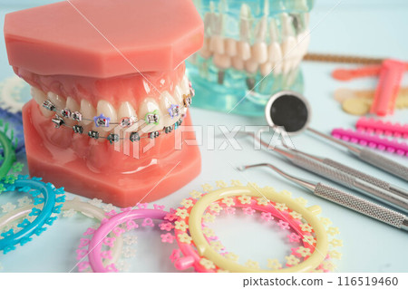 Orthodontic ligatures rings and ties, elastic rubber bands on orthodontic braces, model for dentist studying about dentistry. 116519460