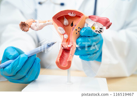Uterus, doctor with anatomy model for study diagnosis and treatment in hospital. 116519467