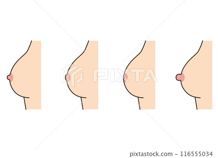 Nipple shape, nipple type, variety 116555034