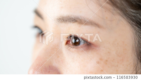 Middle-aged woman with dark spots 116583930