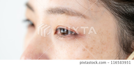 Middle-aged woman with dark spots 116583931
