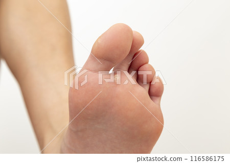 腳底疣，白色背景 116586175