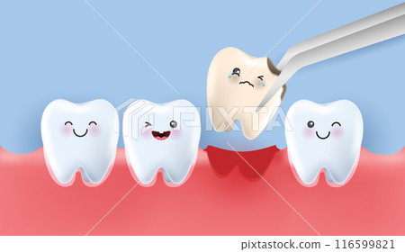 Dental care illustration set. dentists treat tooth decay to avoid pain when chewing. tooth decay treatment concept. remove plaque, treat tooth decay. medical apps, websites and hospital. vector. Dental care illustration set. dentists treat tooth decay to avoid pain when chewing. tooth decay treatment concept. remove plaque, treat tooth decay. medical apps, websites and hospital. vector. 116599821