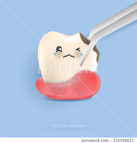 Dental care illustration set. dentists treat tooth decay to avoid pain when chewing. tooth decay treatment concept. remove plaque, treat tooth decay. medical apps, websites and hospital. vector. 116599822