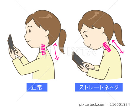 Comparison illustration of a young woman with a straight neck looking at a smartphone 116601524