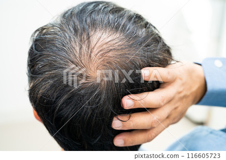 Bald in the middle head and begin no loss hair glabrous of mature Asian business smart active office man. Bald in the middle head and begin no loss hair glabrous of mature Asian business smart active office man. 116605723
