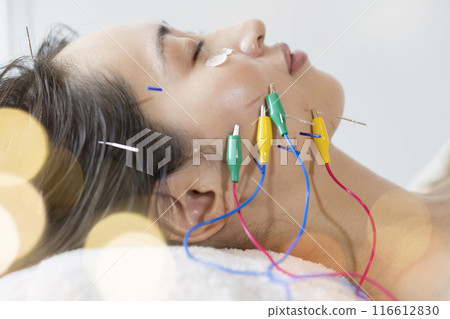 Young woman doing cosmetic acupuncture Young woman doing cosmetic acupuncture 116612830