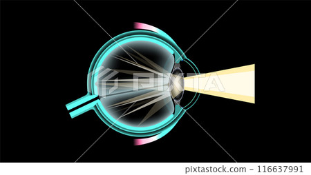 Cataract eye disease 116637991