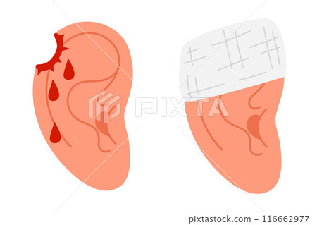 Wounded ear with blood drops and Bandaged human ear. 116662977