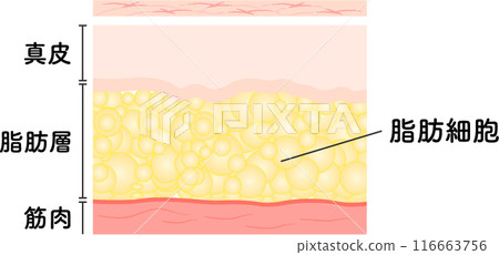 抽脂 橫斷面圖 美容醫學 美容手術 抽脂 橫斷面圖 美容醫學 美容手術 116663756