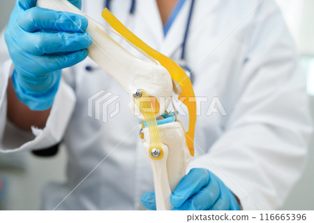 Knee osteoarthritis, Doctor showing model knee joint orthopedic. Knee osteoarthritis, Doctor showing model knee joint orthopedic. 116665396
