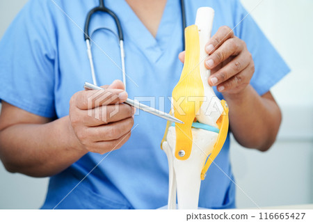 Knee osteoarthritis, Doctor showing model knee joint orthopedic. Knee osteoarthritis, Doctor showing model knee joint orthopedic. 116665427