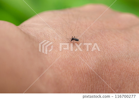 被蚊子叮咬的人 116700277