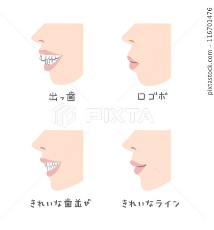 從側面看女人嘴的插圖 從側面看女人嘴的插圖 116701476