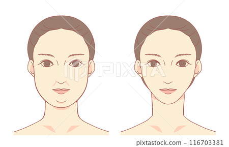 Double chin and small face illustration Double chin and small face illustration 116703381