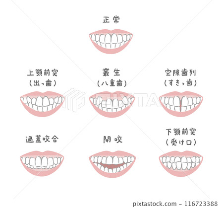 Illustration set of women with various teeth alignment 116723388