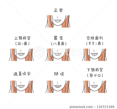 具有各種牙齒排列的女性插圖集 116723389