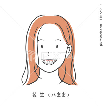 Illustration material of a woman with bad teeth alignment 116723395