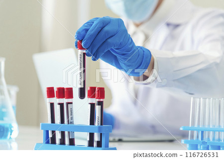 Close up Scientist man hands holding sample blood test tube science laboratory. Doctor clinic healthcare technician lab testing blood sample diagnosis. Crop man scientist hands testing medical lab Close up Scientist man hands holding sample blood test tube science laboratory. Doctor clinic healthcare technician lab testing blood sample diagnosis. Crop man scientist hands testing medical lab 116726531