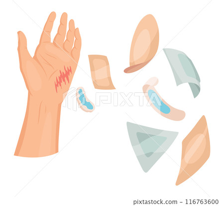 Hand injured skin and procedures of bandaging and wound cleaning. First aid for wound. Medicine cure or treatment. First emergency help for human hand trauma 116763600