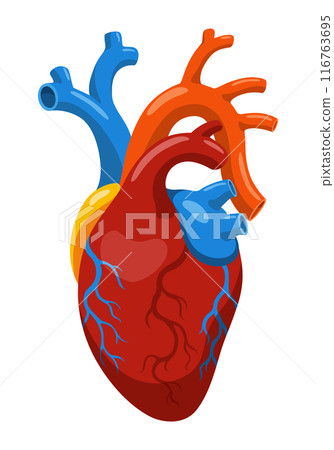 Atherosclerosis stage. Anatomy of heart attack. Arteriosclerotic vascular disease or ASVD. Vector illustration on white background Atherosclerosis stage. Anatomy of heart attack. Arteriosclerotic vascular disease or ASVD. Vector illustration on white background 116763695