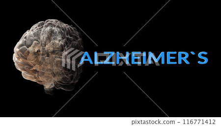 Alzheimer's Disease Brain Deterioration 116771412