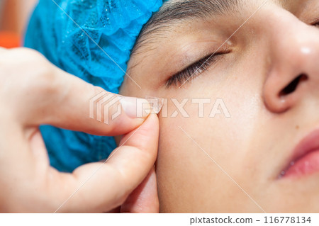 Close up of a young male patient face after a benign skin lesion removal at dermatologist office. 116778134