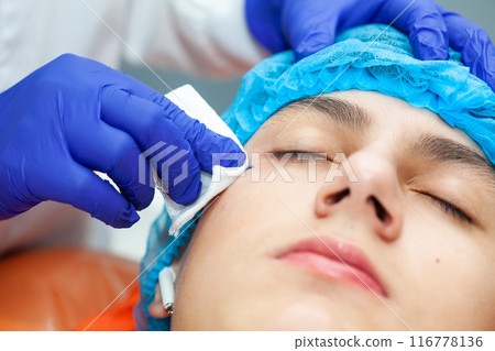 Close up of a young male patient face after a benign skin lesion removal at dermatologist office. 116778136