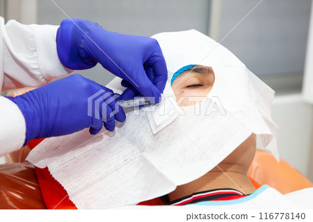 Skin lesion removal procedure. Dermatologist carrying out a removal of benign skin lesion on the face of a young male patient. 116778140