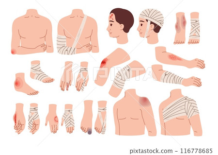 Applying bandages to wounds. Fixation and isolation of bruises. Bone fractures. Affected body parts. Physical injury. Emergency help. Hospital treatment. Plaster at knee. Recent vector set 116778685