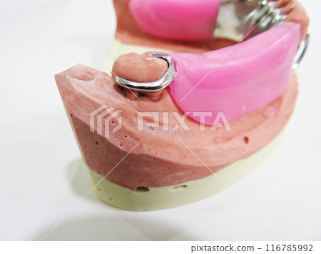 Metal clasp of Partial Denture Metal clasp of Partial Denture 116785992