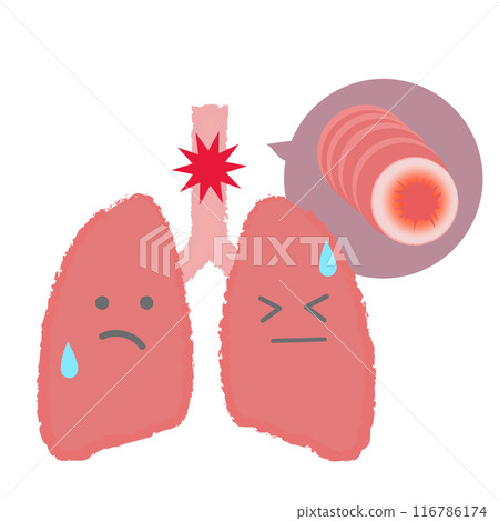 Bronchi and lungs, asthma disease illustration character Bronchi and lungs, asthma disease illustration character 116786174